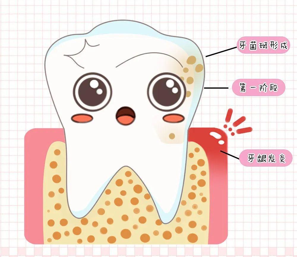 牙龈出血真的无所谓?