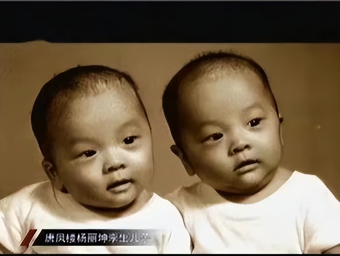 杨丽坤的双胞胎图片