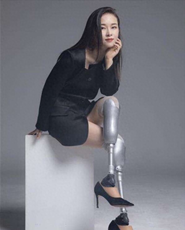 回顾四川女孩廖智:汶川地震失去双腿,后被丈夫抛弃,如今怎么样了?