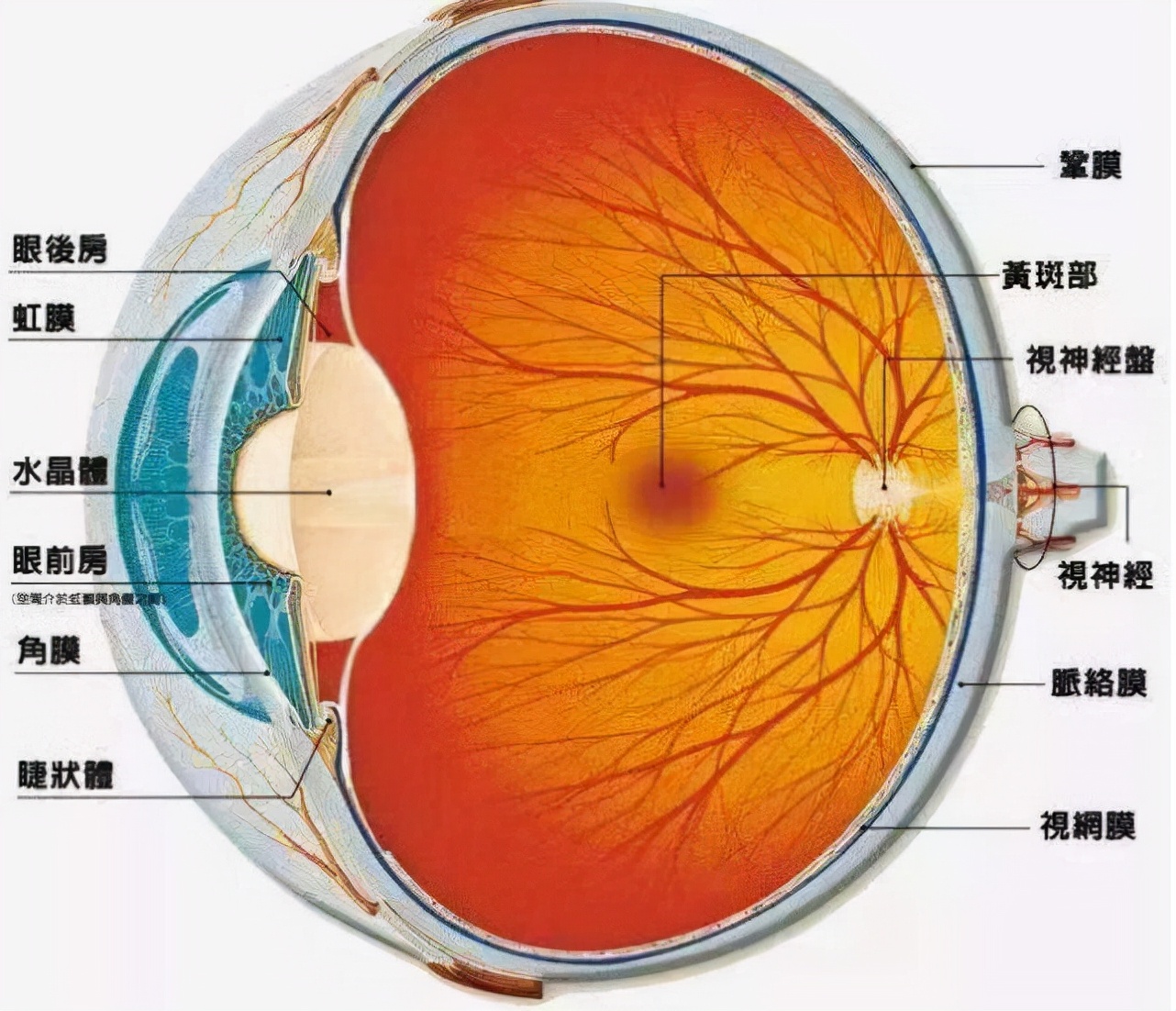 罕见疾病回旋状脉络膜视网膜萎缩,具有遗传性质,易引起其他病症