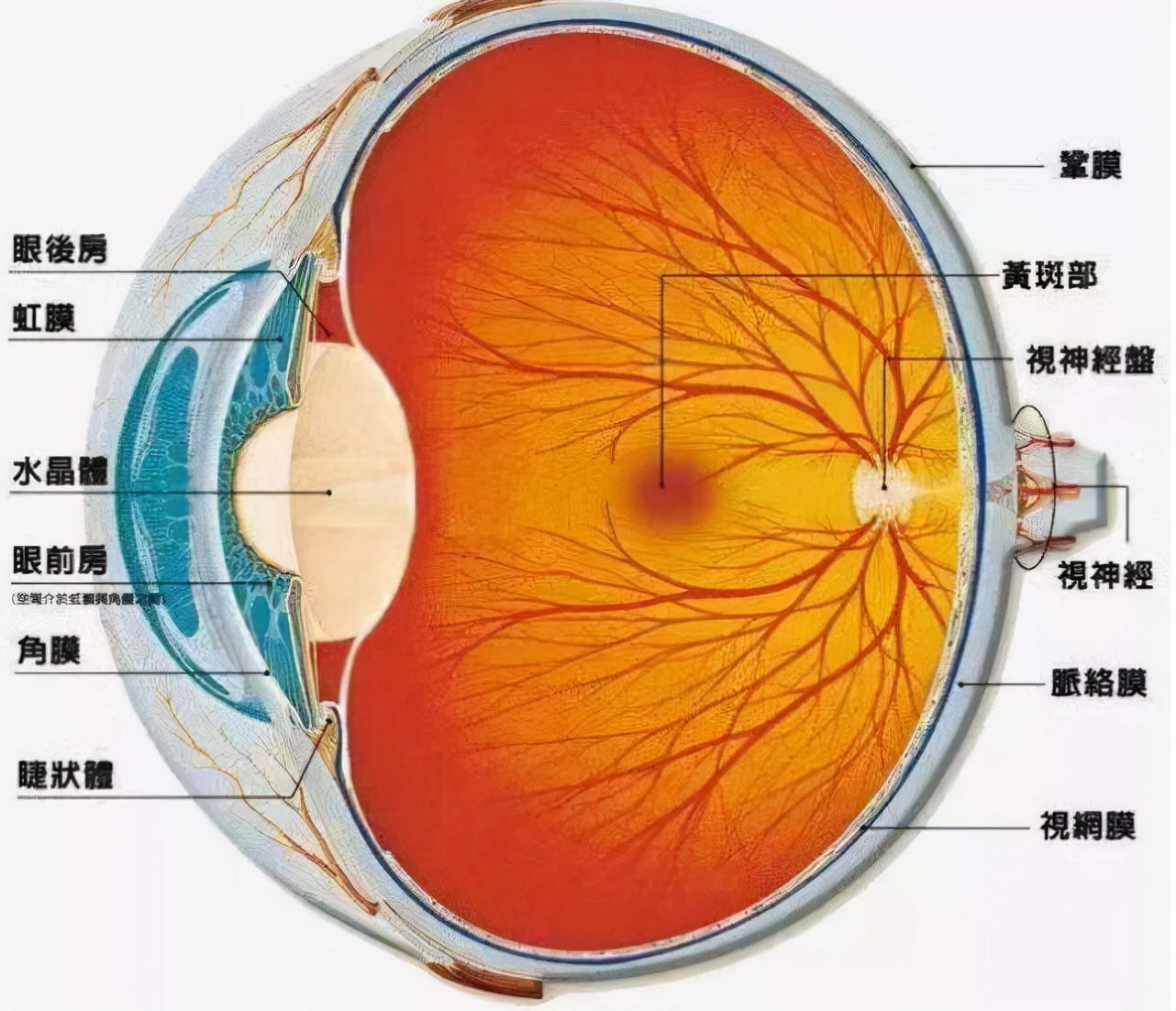 脉络膜裂位置图片