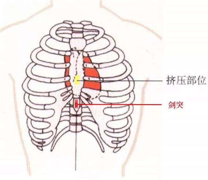 心脏下面隐隐作痛图片