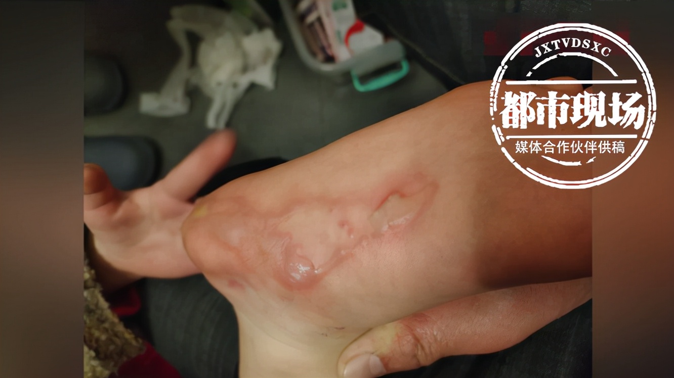 烧坏棉被烫伤娃,这是"电热毯之过"?