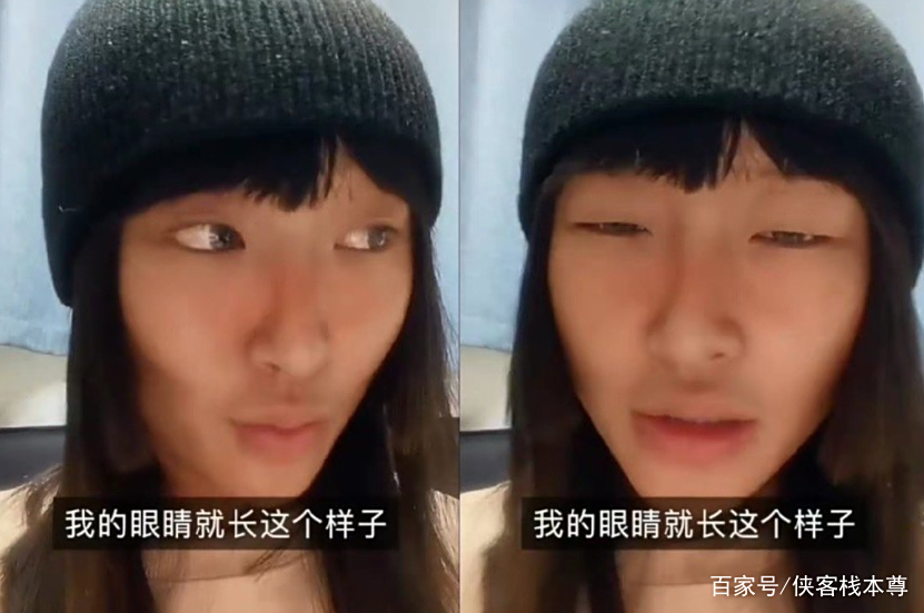 为什么我的眼睛