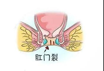 老外不吃的食物,中国人却吃不腻?医生提醒:不吃是对的