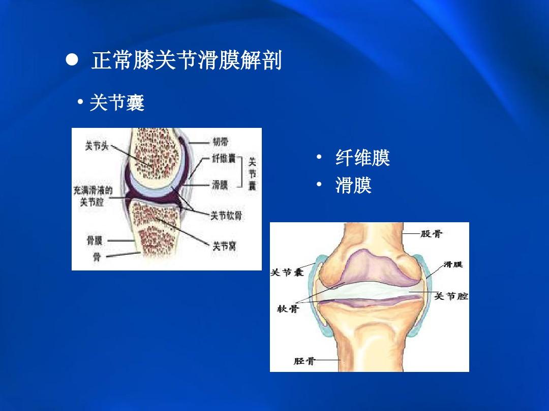 膝关节结核,是由结核杆菌引起的,主要临床表现是单侧关节发病