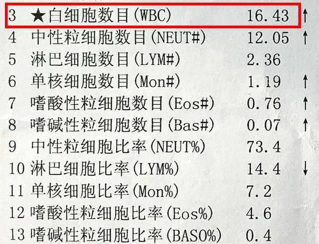 血常规检查,若是这4指标升高,要警惕起来,别忽略!