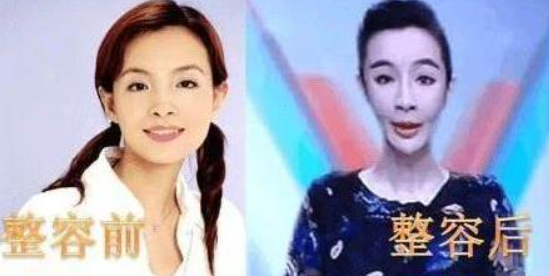 她是央视著名女主持人,却因整容丢掉前途,网友:看见她就关电视