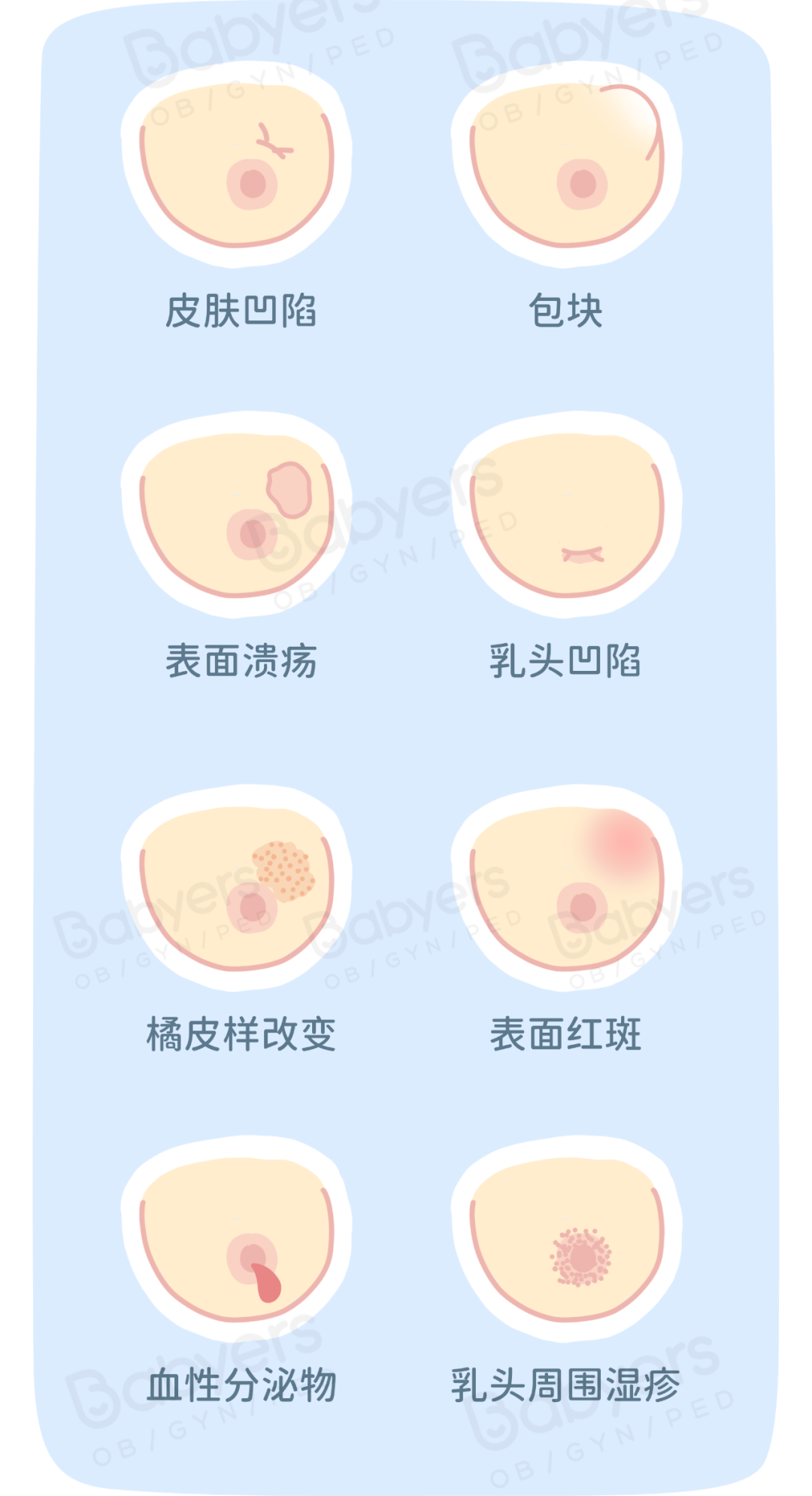 杭州美华提醒:一张图教你「乳房自检」,乳腺问题早发现