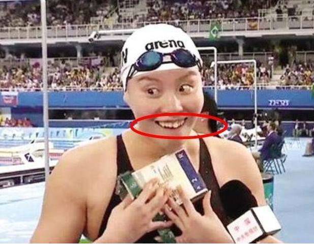 有种"整容"叫傅园慧,整牙前后判若两人:被严重低估的颜值