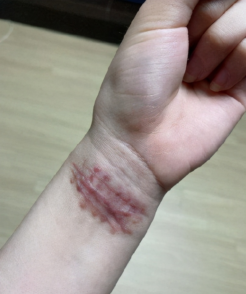 权珉娥公布恋情被骂惨,与男友超亲密贴身,曾被霸凌10年患抑郁症