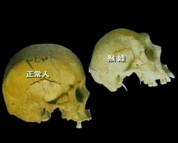 湖北神农架惊现"猴娃,传闻其母与野人所生,真相究竟是怎样?