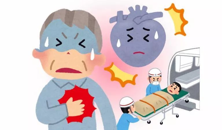 男子心肌梗死,为何检查血管却没有狭窄,没有闭塞?医生讲解答案