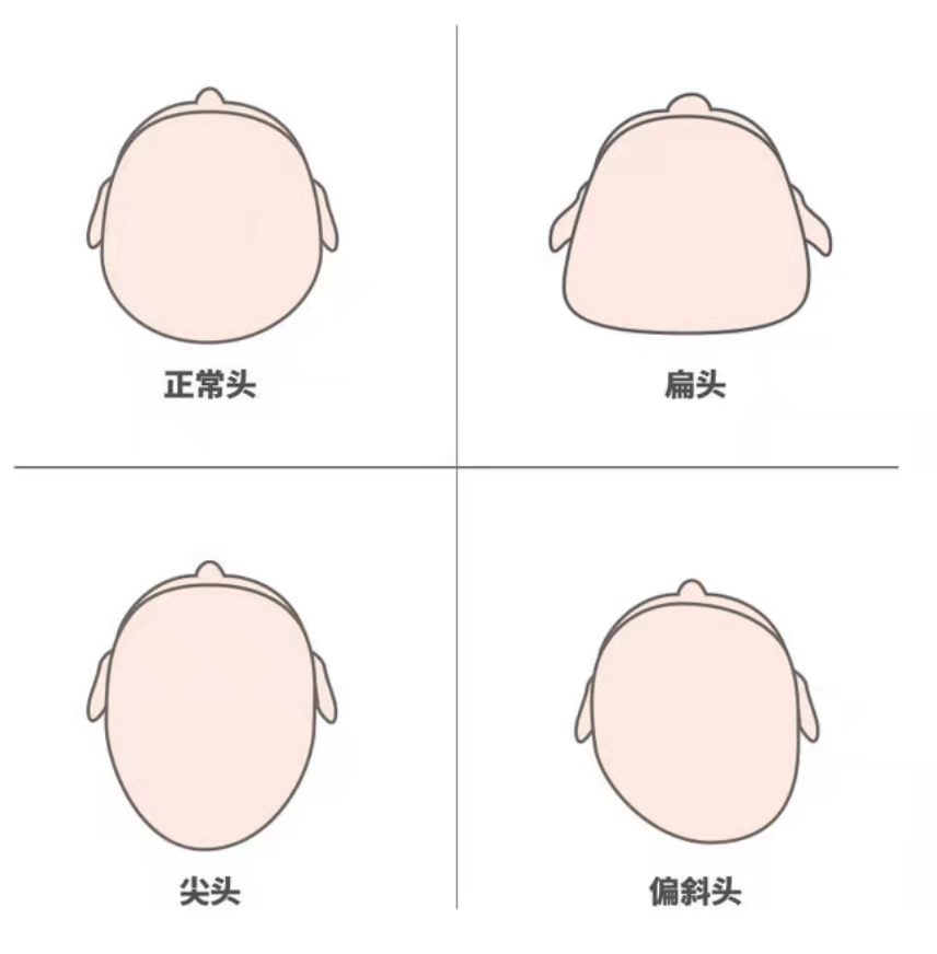 高颜值弥补不了头型的缺陷,让宝宝有一个好头型,妈妈要做到三点
