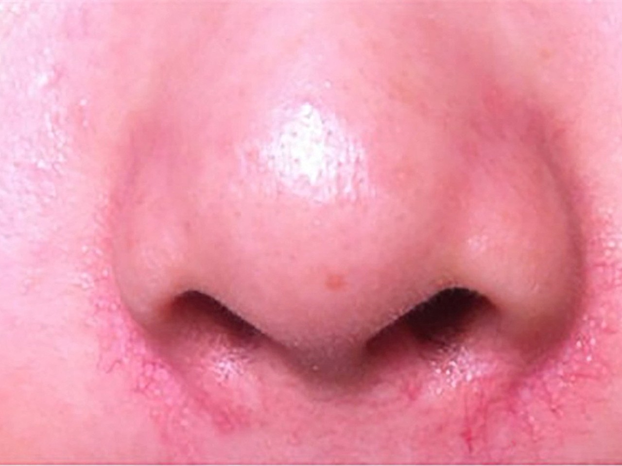 肝变硬,头先知?医生提醒:头部若出现这几种情况,建议早检查