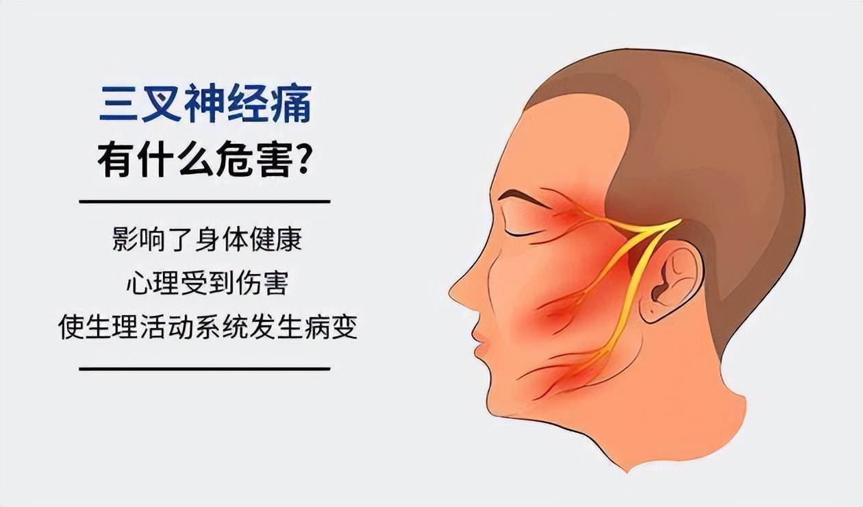 李燕:三叉神经痛有哪些症状?脸上电击样疼痛,小心三叉神经痛!