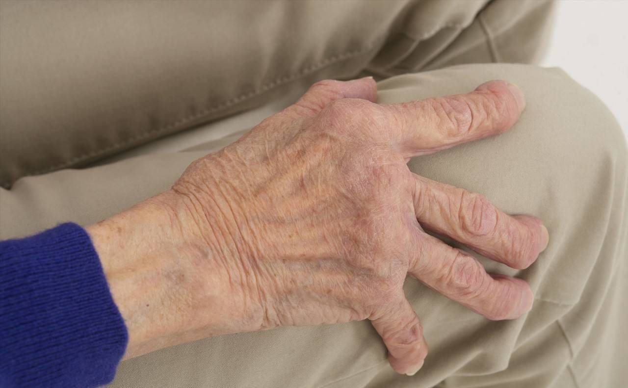 50岁左右的中老年人,手指肿胀,僵硬,握不拢,预示着哪些疾病?