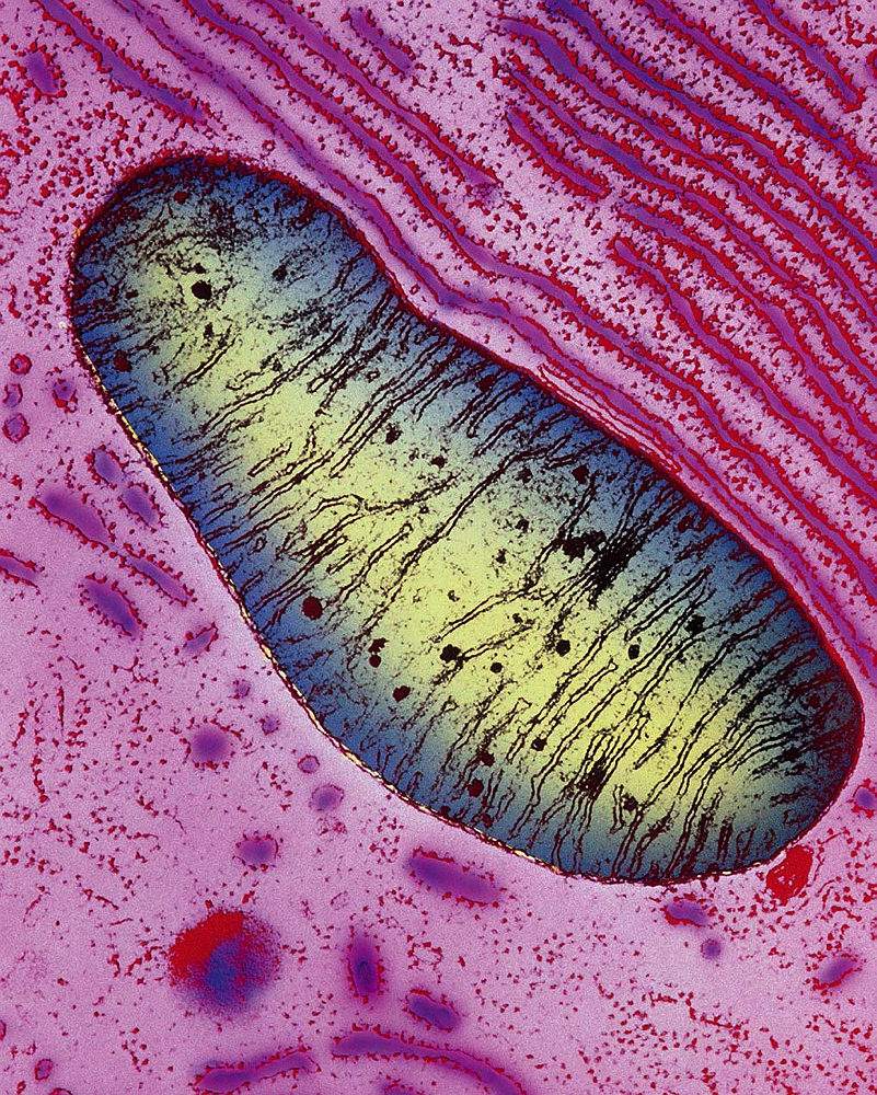 罕见遗传疾病线粒体脑肌病,发病症状十分明显,影响患者身体运作