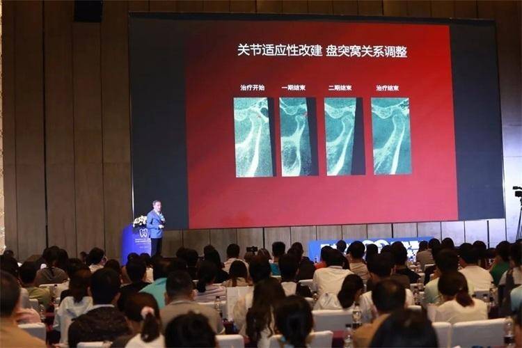 正畸论坛|沈刚授课《颌位因素突面不当治疗原因后果及补救方案》