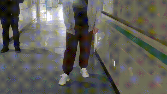 脑梗后挎篮肘,爪形手等严重影响生活!章鱼康护助力偏瘫患者康复