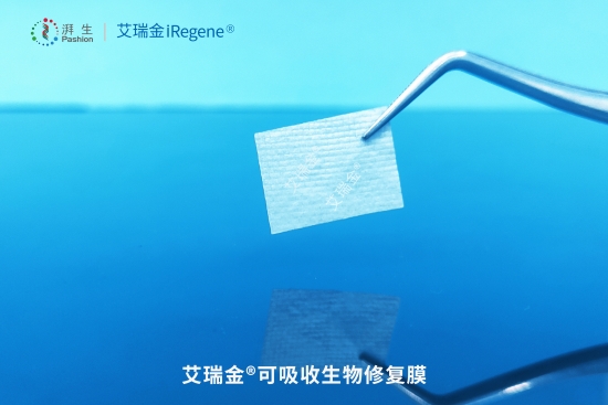 艾瑞金口腔学院-优诺口腔冯楠讲授湃生生物膜应用于水平骨增量