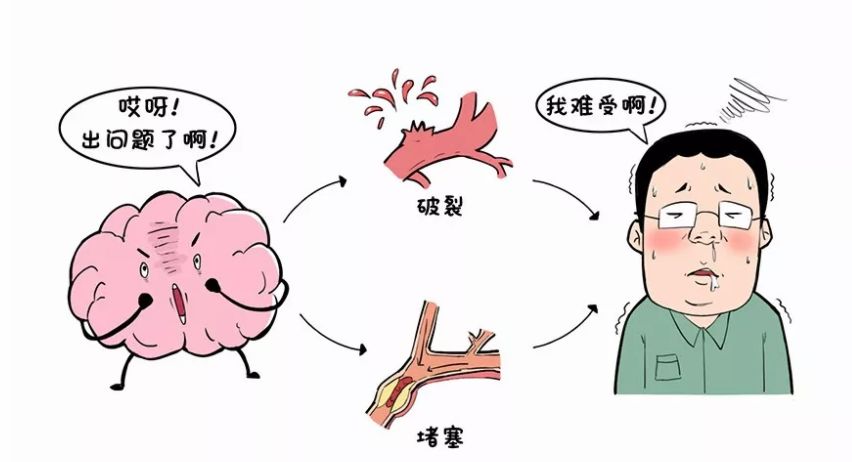 十个生活习惯帮你远离脑卒中,三高人群谨记|国家卫健委在线访谈