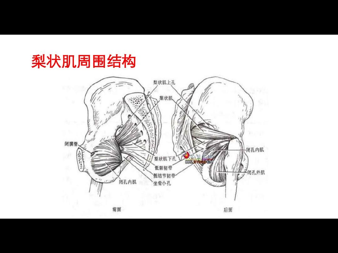 梨状肌症候群由寒冷等因素引发,发病机制是瘢痕组织压迫坐骨神经