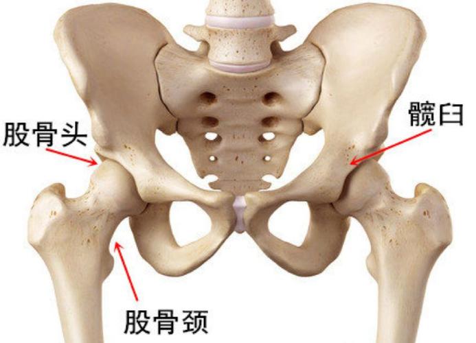 股骨頭壞死的