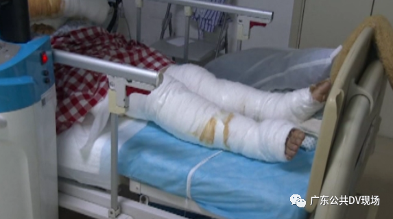 推荐“一阵光从外面进来！”女子在家中被雷击倒严重烧伤，防盗门都弹飞了！