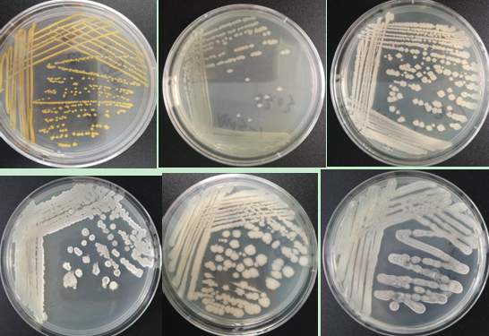 微生物四区划线法图片图片