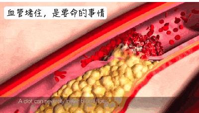 |气到心梗！一男子辅导孩子作业突然晕倒，入院抢救