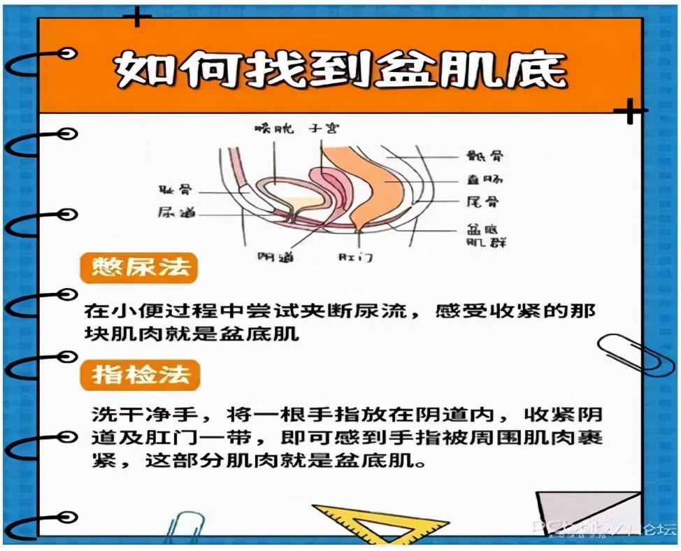 女性漏尿最佳治疗方法图片