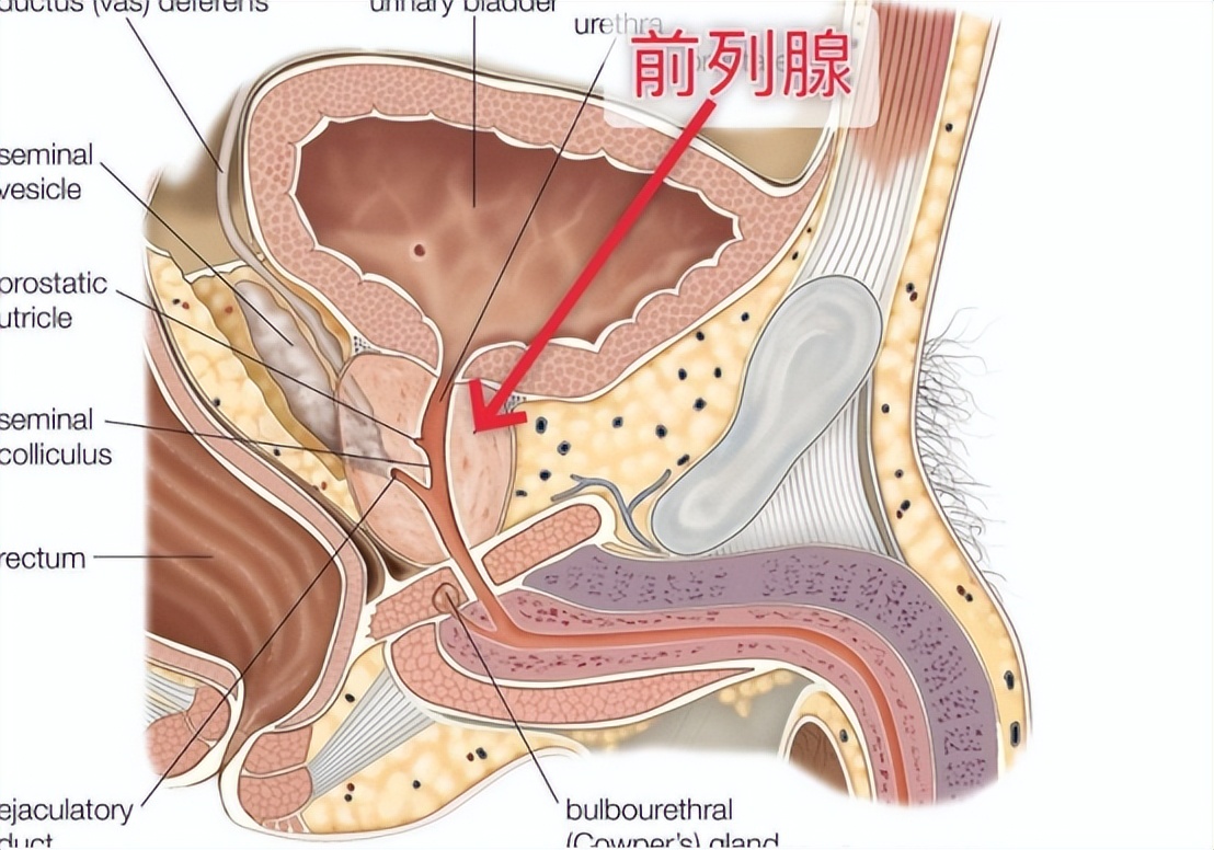 什么信号提示前列腺增生需要干预?医生 出现5种情况要留意