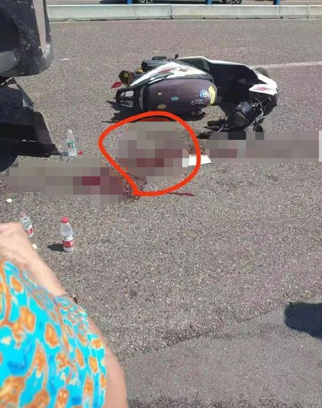 摩托车祸撞飞"蛋蛋",散落滚烫柏油马路上,还能再移植回去吗?