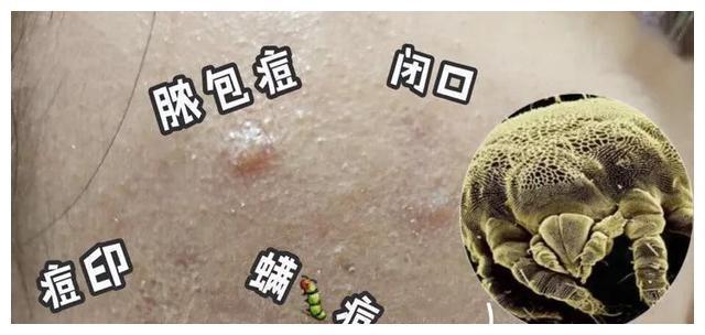 枕头只用不洗,螨虫成窝?这样清洁比晒还管用