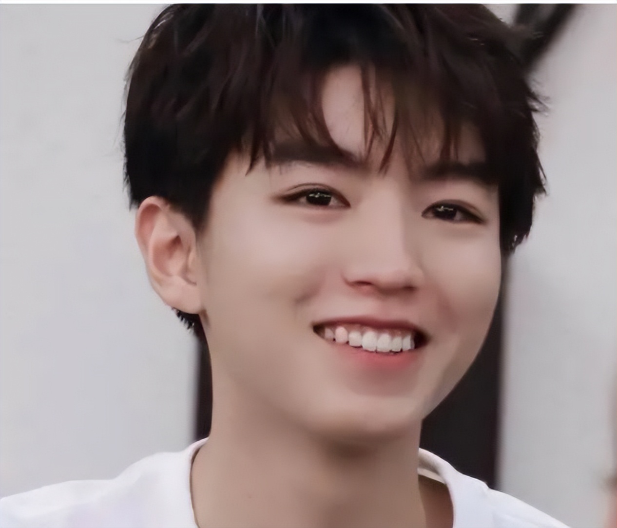 戴牙套是双刃剑:毛不易拯救一口烂牙,刘雯,肖战却变难看了