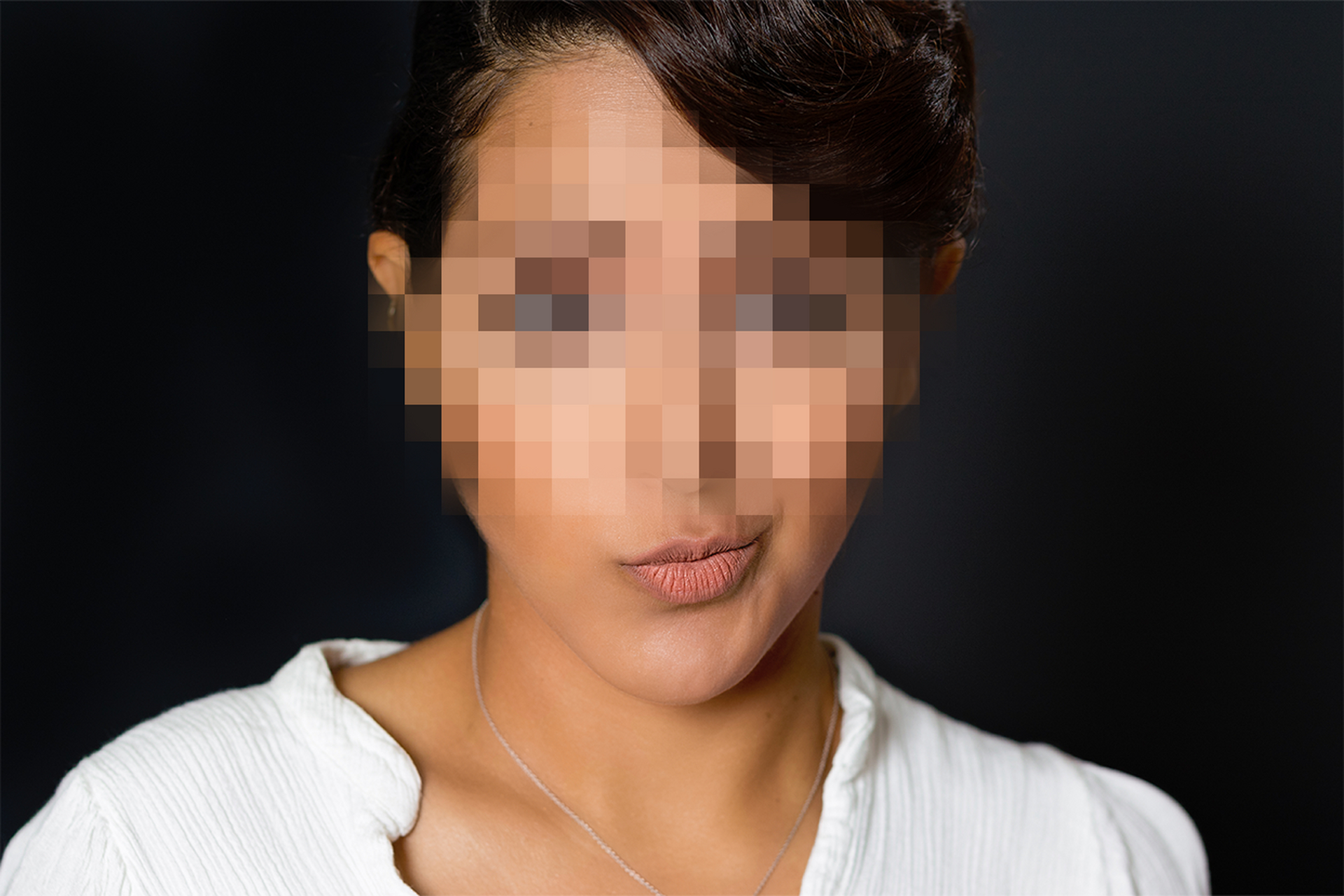 单侧咀嚼歪脸用另一侧咀嚼能恢复吗  歪脸已经好几年了,不知道还能不