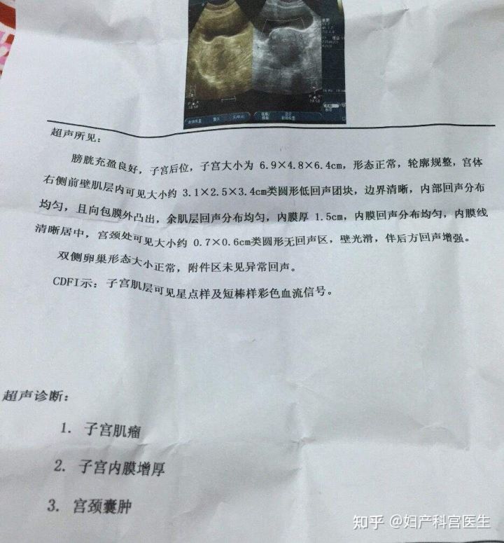 宫颈囊肿是个啥?