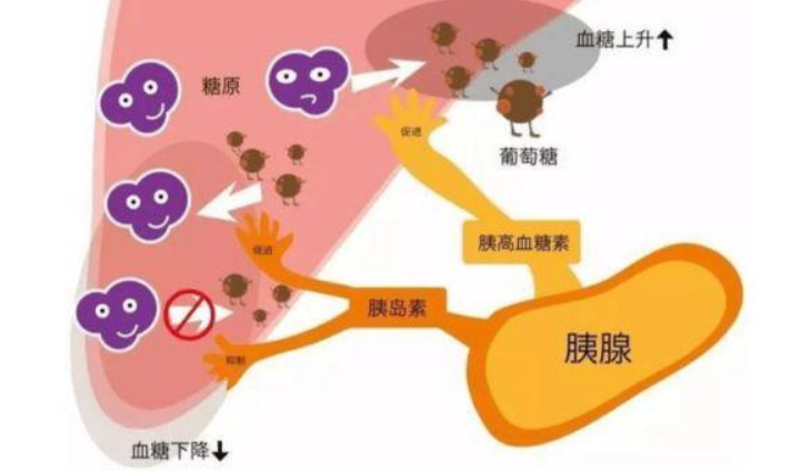 自身免疫性胰岛素受体病的临床症状较多,主要治疗方法有四种
