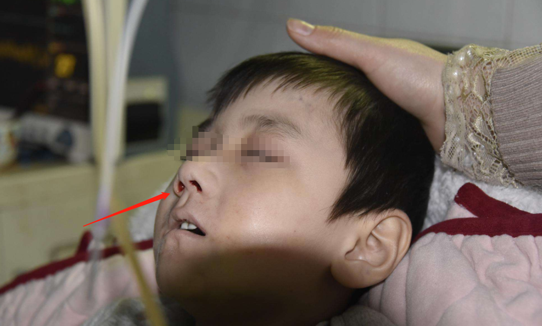 6岁开始喝饮料,如今患上尿毒症,很多孩子喜欢喝,家长要注意了