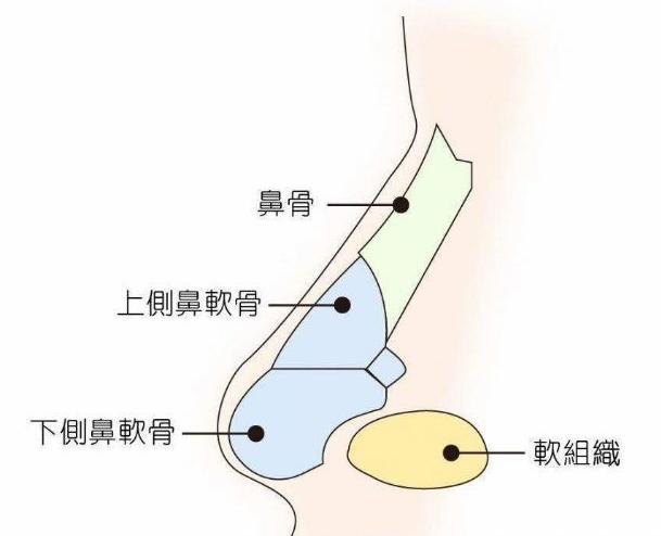 鼻子透光就等于做了隆鼻手术吗?