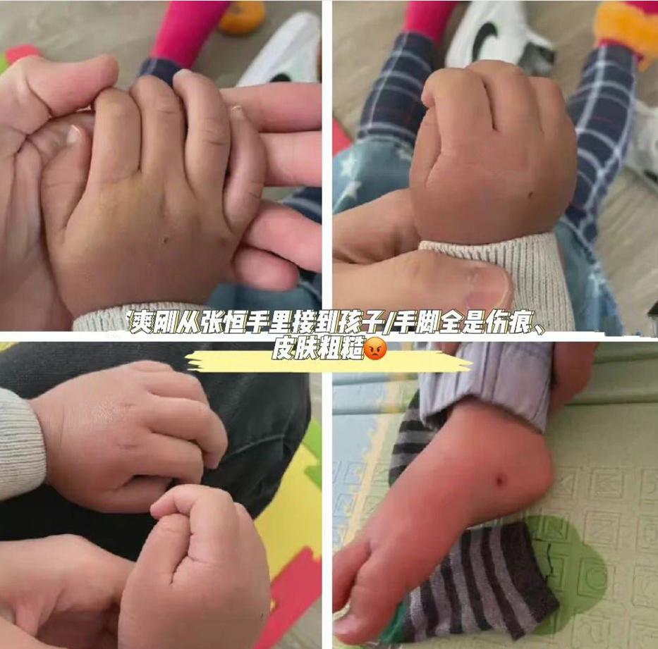 爽子虐童事件继续发酵,其父发相关视频力证是谣传,张恒逐一回应