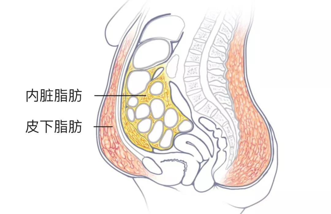 腰腹环吸术后多久可以恢复?选择半麻还是全麻?