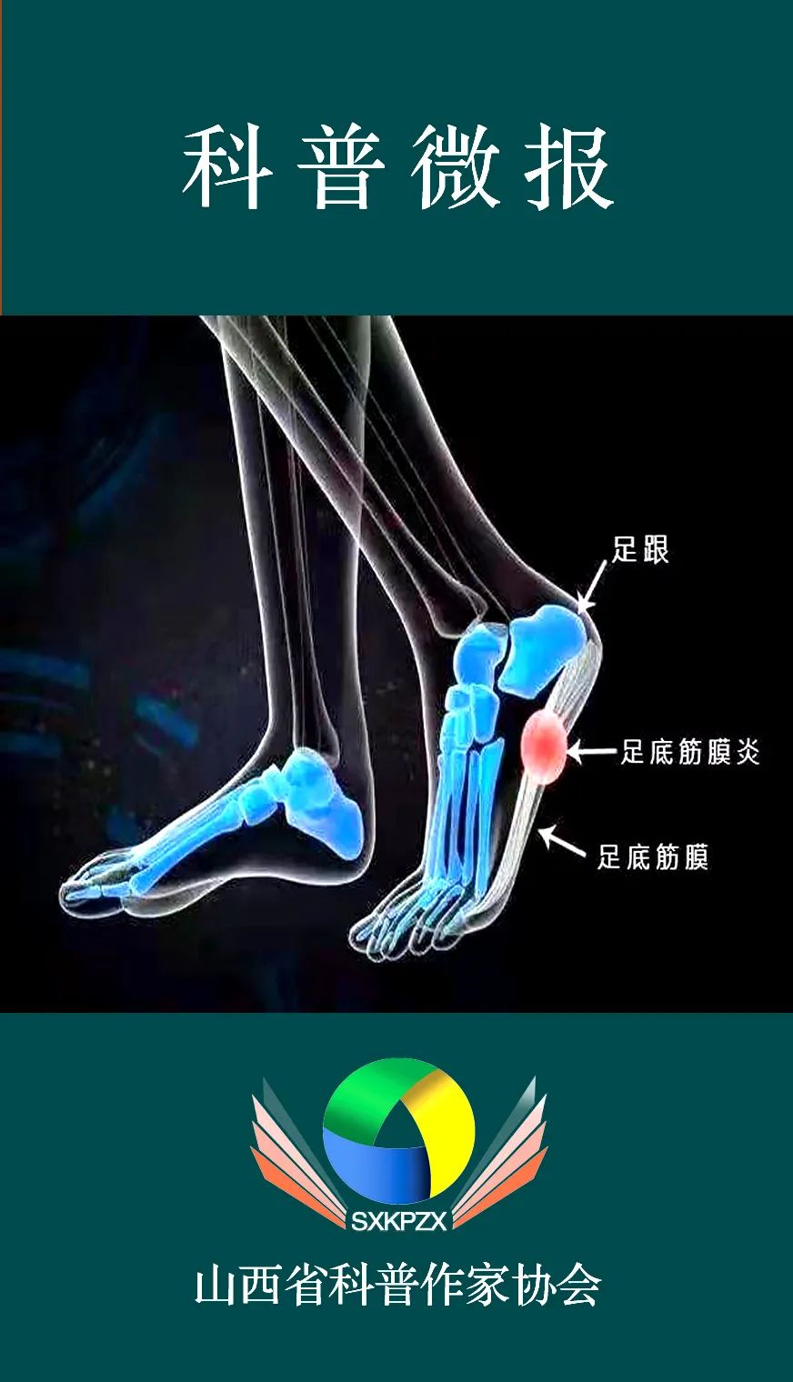 跟腱疼是怎么回事图片