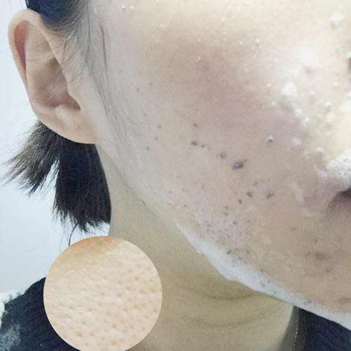 晒黑了多久能恢复?怎么快速变白回来?