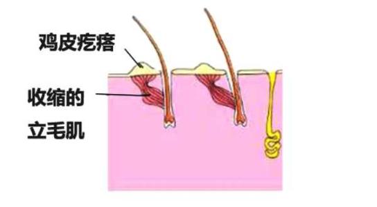 鸡皮疙瘩可以用香蕉皮抹吗(鸡皮疙瘩可以用香蕉皮抹吗图片)