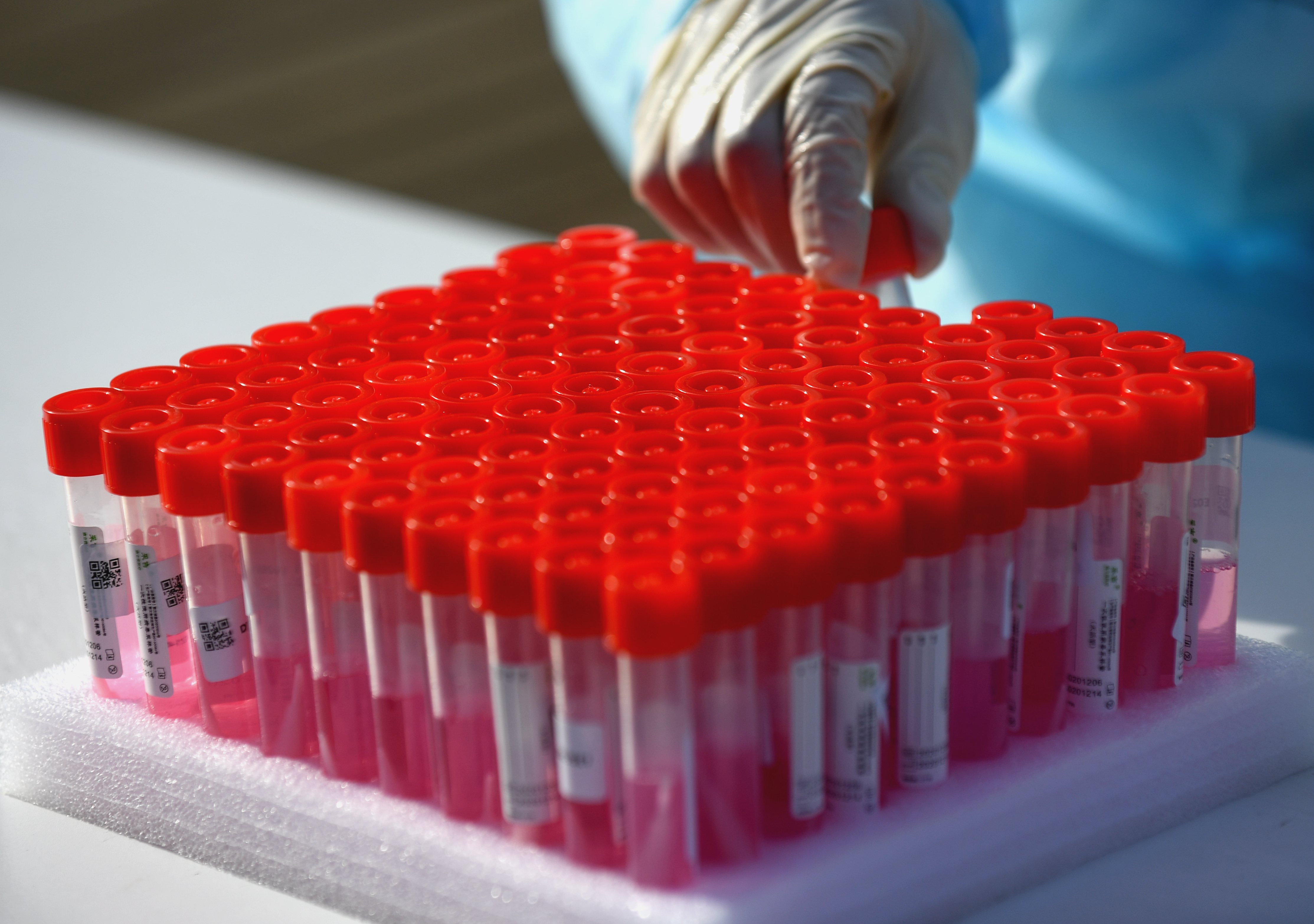 河北石家庄:核酸检测进行时