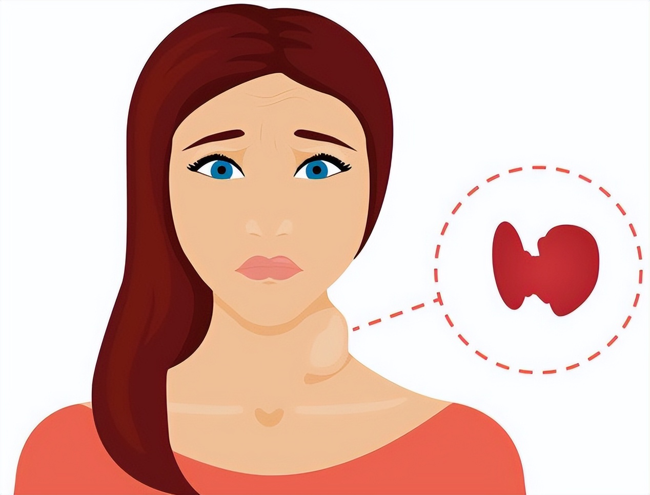 甲亢是怎么一回事儿呢?一文说清楚!