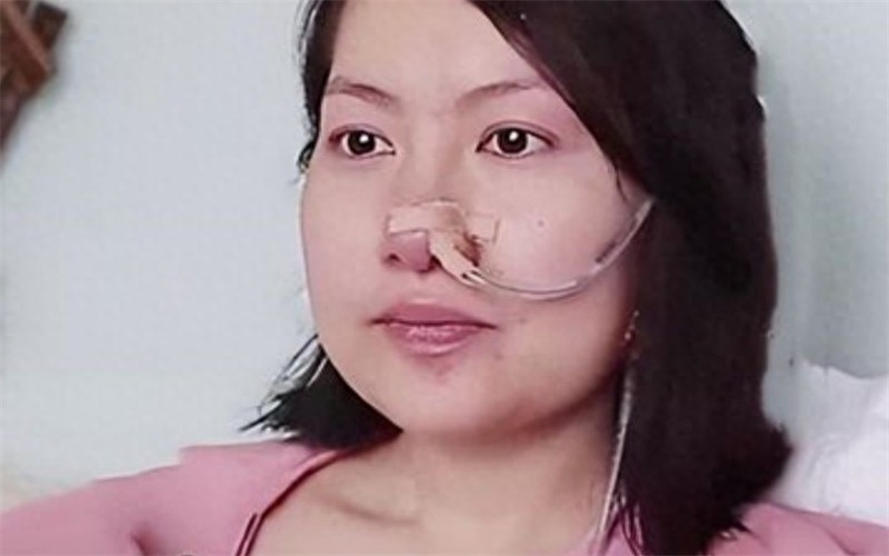 回顾80后患癌女孩:临终前办派对,卖萌耍乖让亲人把眼泪憋回去