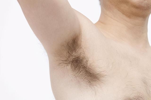 腋毛为何会变白呢?可能没你想得那么简单,别太大意了